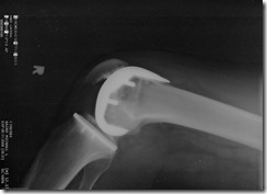 knee joint by mikebaird